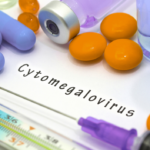 Cytomegalovirus ICD-10 Code